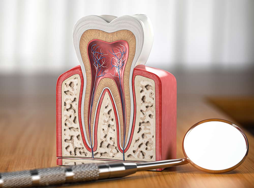 Painless-Root-Canal-Treatment