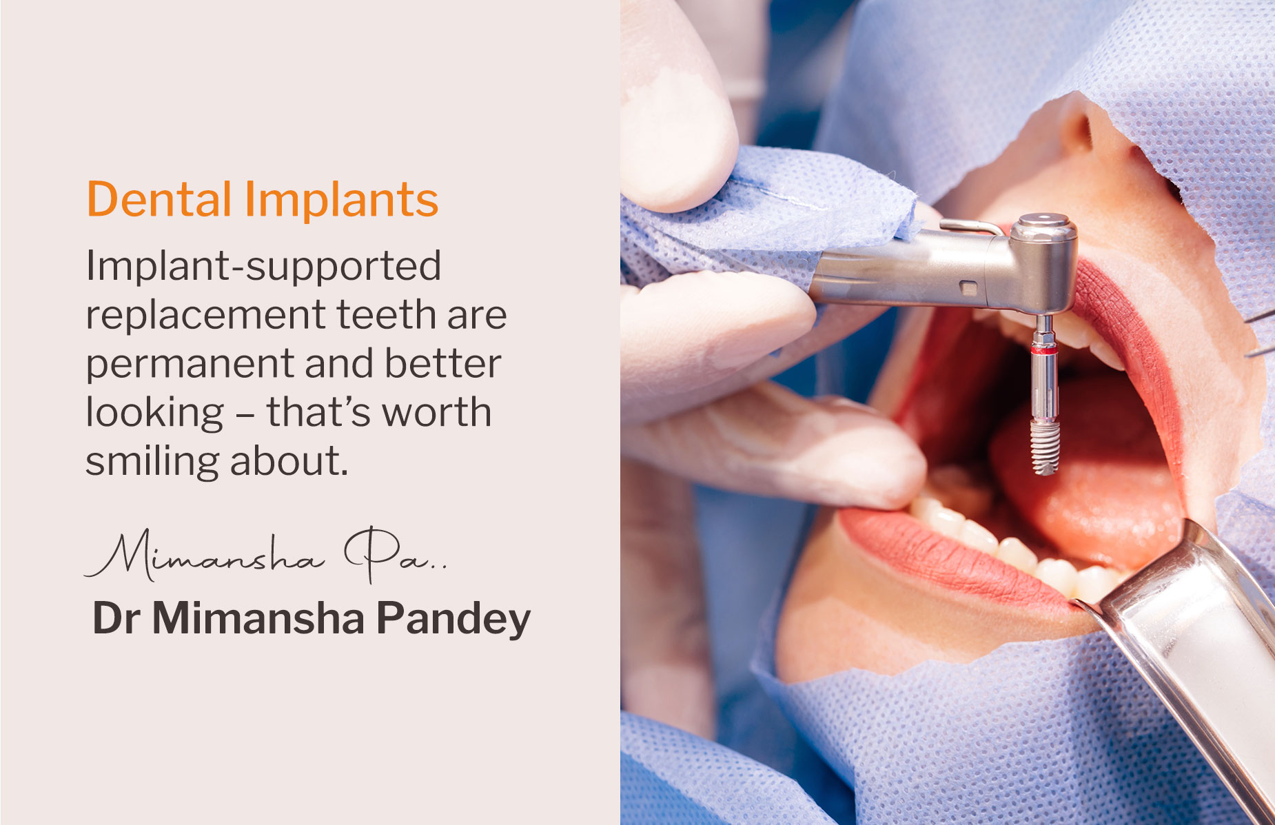 Dental Implants in Indore | My Dentist Indore